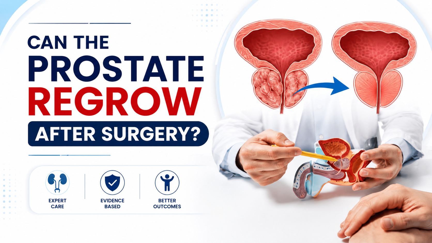 Prostate Removal (Prostatectomy): Your Comprehensive Guide to Surgery ...