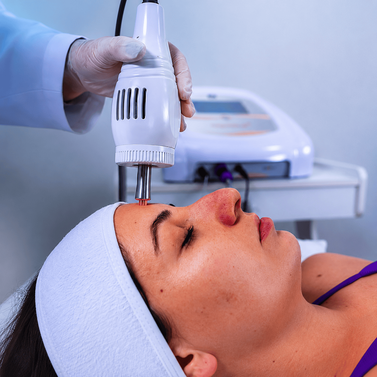 Cryotecar em estética facial
