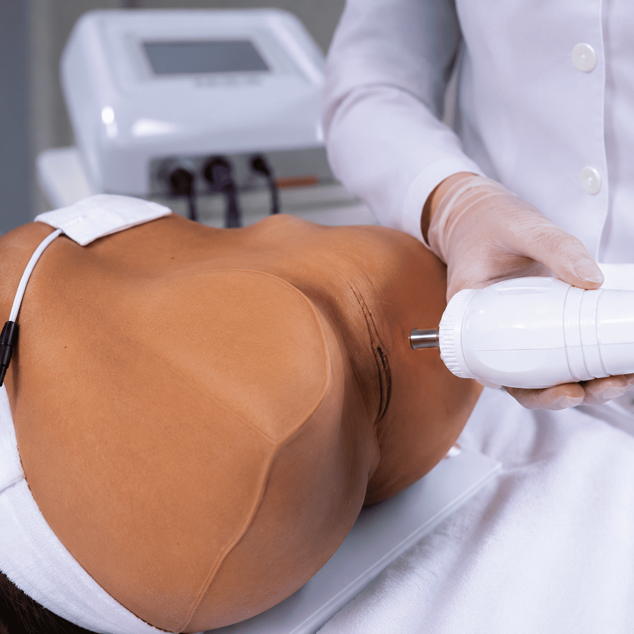 Cryotecar em estética íntima