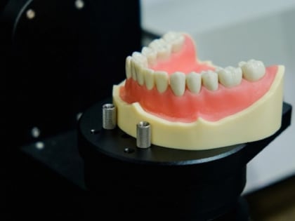 Плохая гигиена полости рта повышает риск развития заболеваний мозга