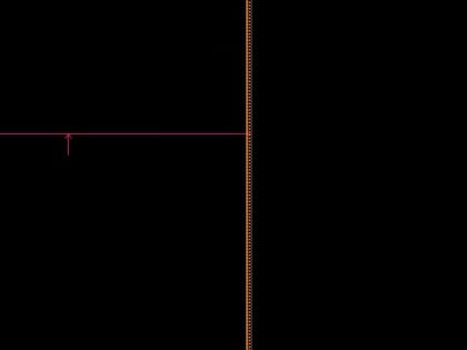 Учёные СибГМУ разработали новый способ диагностики остеомиелита у пациентов с синдромом диабетической стопы 