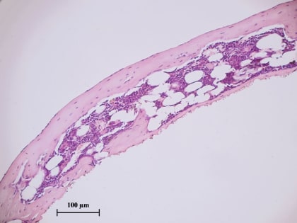 Учёные СибГМУ разработали способ улучшить приживление костных имплантатов