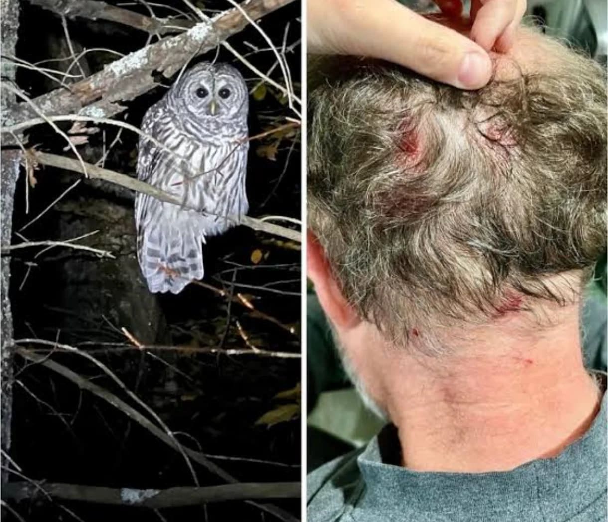 Owl attack on human