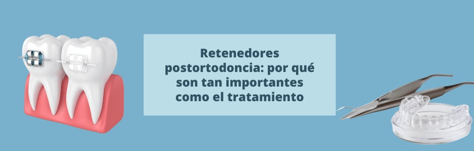 Retenedores postortodoncia: por qué son tan importantes como el tratamiento