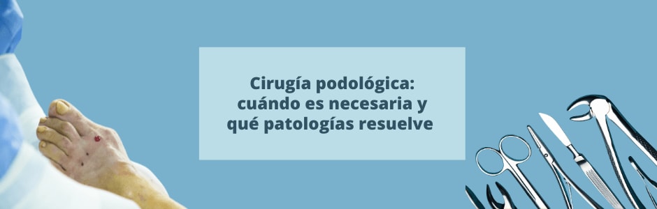 Cirugía podológica: cuándo es necesaria y qué patologías resuelve