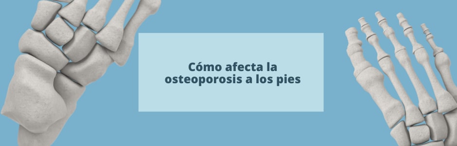 Cómo afecta la osteoporosis a los pies