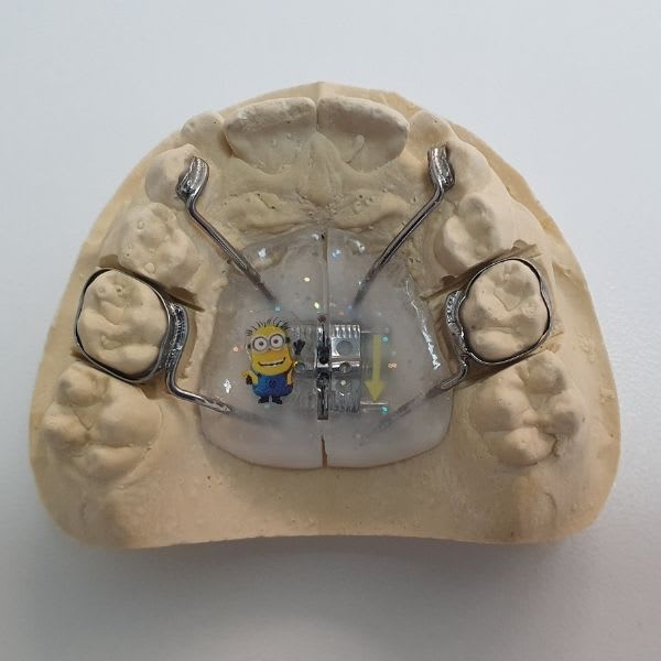 Ortodoncia interceptiva infantil en Herrera