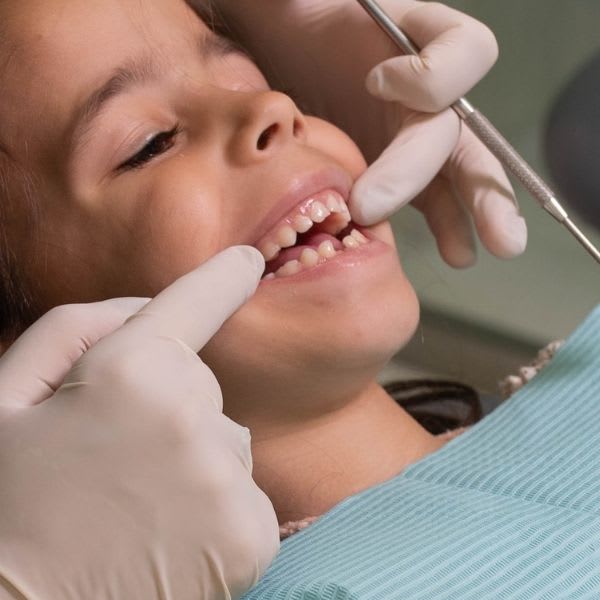 Traumatología dental infantil en Herrera