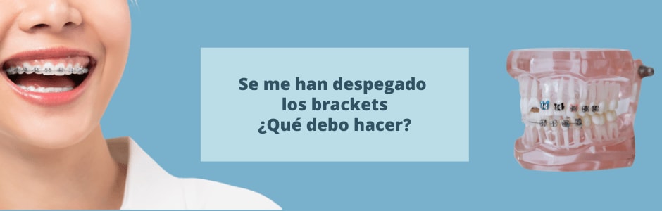 Se me han despegado los brackets ¿Qué debo hacer?