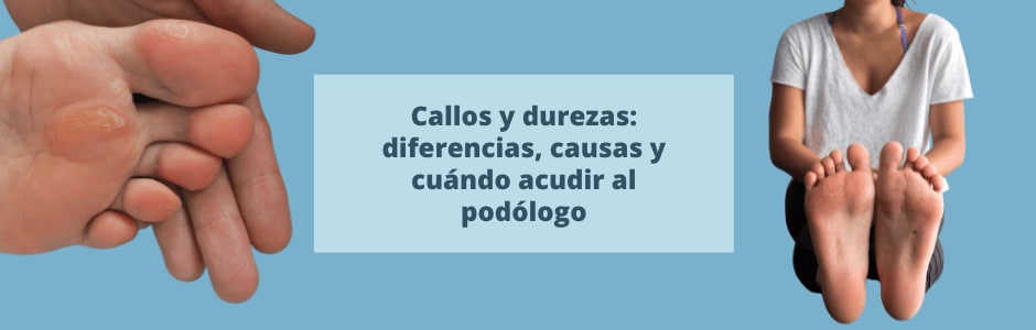 Callos y durezas: diferencias, causas y cuándo acudir al podólogo