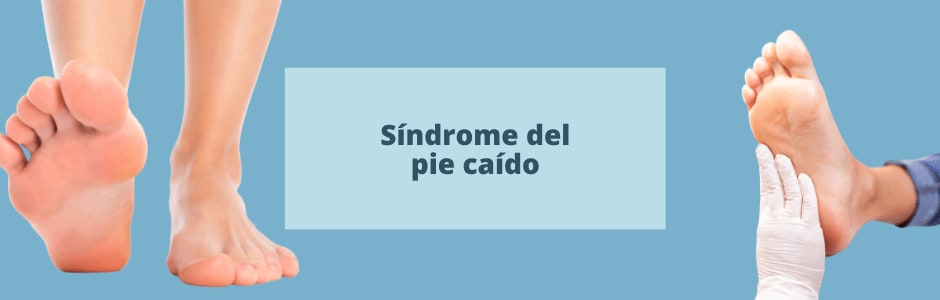 Qué es el síndrome del pie caído