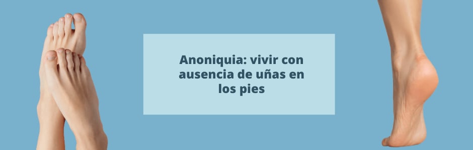 Anoniquia: vivir con ausencia de uñas en los pies