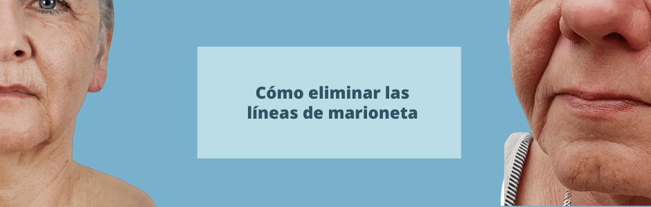Cómo eliminar las líneas de marioneta