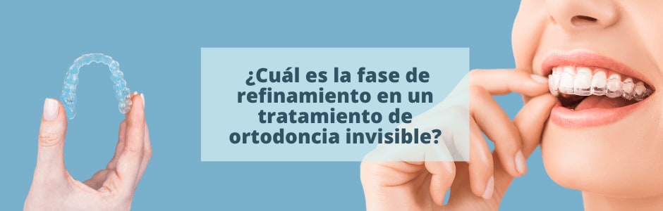 ¿Cuál es la fase de refinamiento en un tratamiento de ortodoncia invisible?