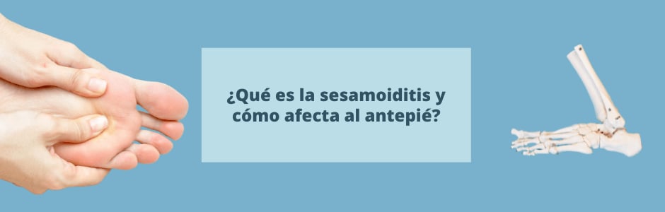 ¿Qué es la sesamoiditis y cómo afecta al antepié?