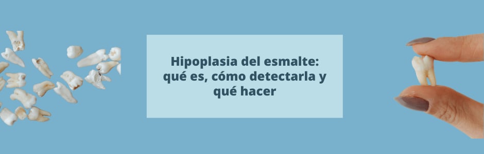 Hipoplasia del esmalte: qué es, cómo detectarla y qué hacer