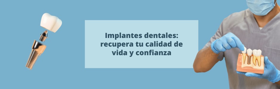 Implantes dentales: recupera tu calidad de vida y confianza