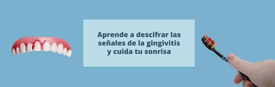 Aprende a descifrar las señales de la gingivitis y cuida tu sonrisa