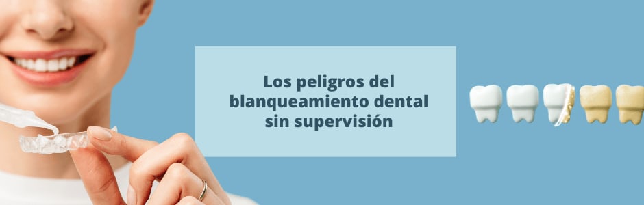Los peligros del blanqueamiento dental sin supervisión