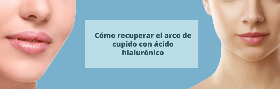 Cómo recuperar el arco de cupido con ácido hialurónico