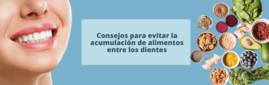 Consejos para evitar la acumulación de alimentos entre los dientes