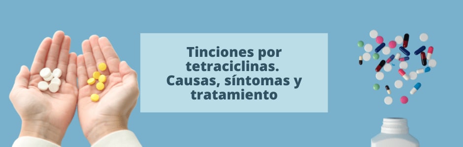 Tinciones por tetraciclinas: causas, síntomas y tratamiento