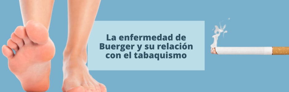 La enfermedad de Buerger y su relación con el tabaquismo