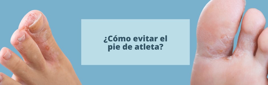 Cómo evitar el pie de atleta