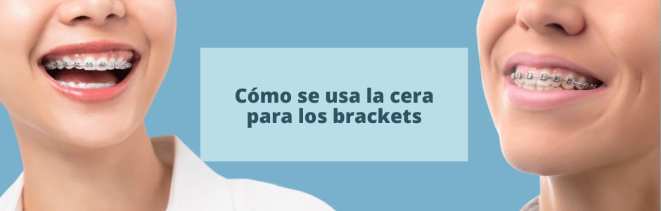 Cómo se usa la cera para los brackets