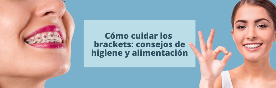 Cómo cuidar los brackets: consejos de higiene y alimentación