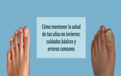 Cómo mantener la salud de tus uñas en invierno: cuidados básicos y errores comunes