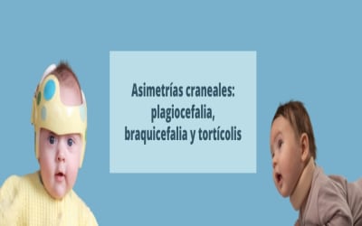 Asimetrías craneales: plagiocefalia, braquicefalia y tortícolis
