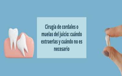 Cirugía de cordales o muelas del juicio: cuándo extraerlas y cuándo no es necesario