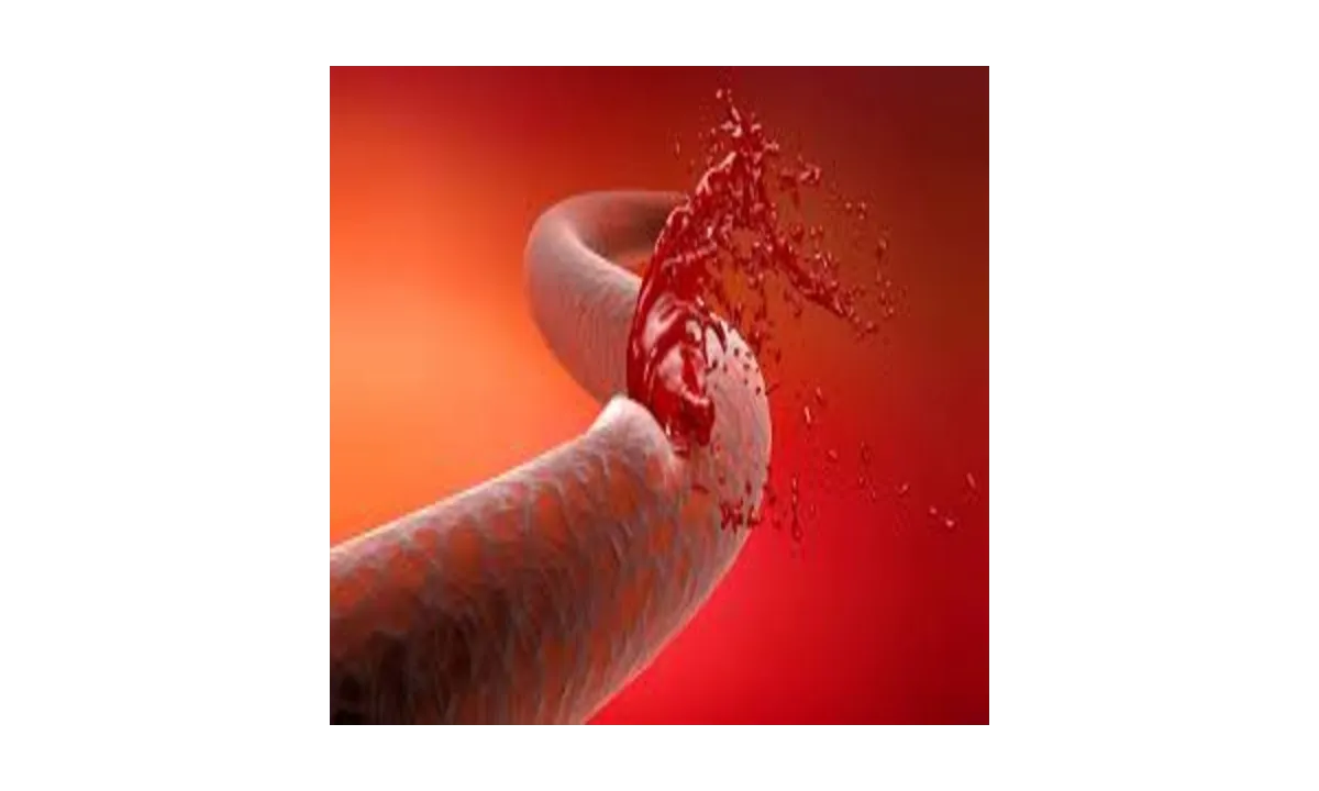 Understanding Prophylaxis: The Gold Standard in Hemophilia Care