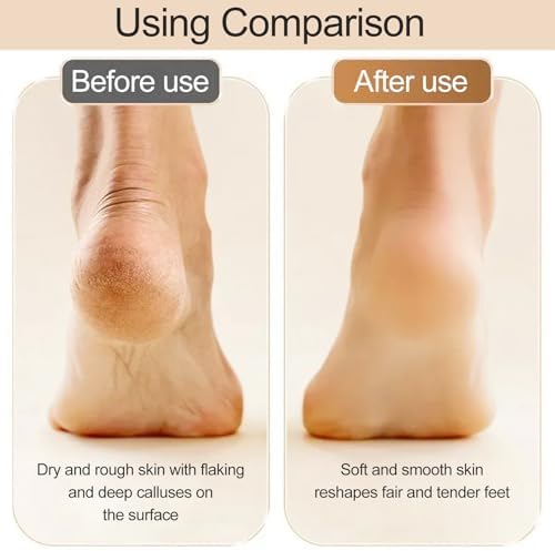 Vue 6 de Rape Electrique Pieds Anti