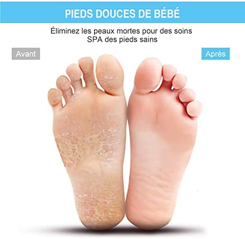 Vue 5 de Honyin Grand Brosse Pieds