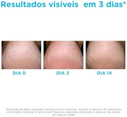 Vue 2 de Isdin Ureadin Podos Ml