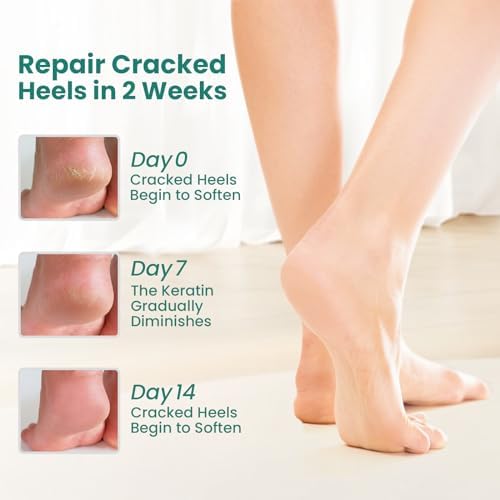 Vue 2 de Welnove Lot De Paires