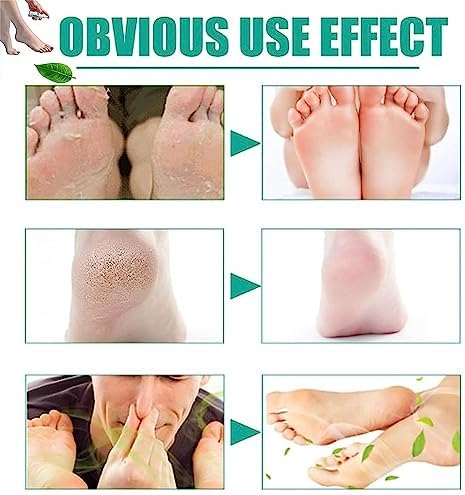 Vue 6 de Serum Pour Les Pieds