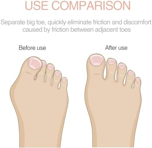 Vue 6 de Xenqito Lot De Paires