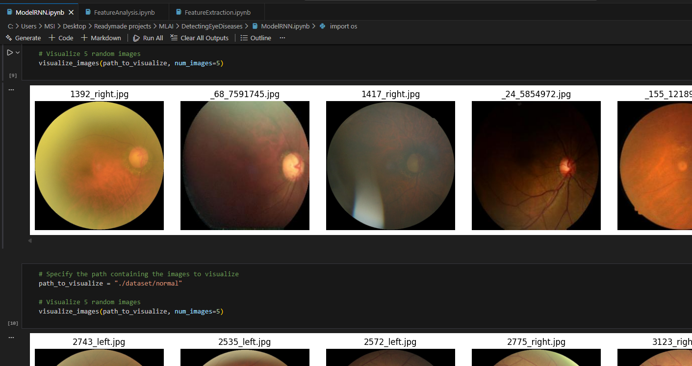 AI-Powered Eye Disease Detection System - Deep Learning Project
