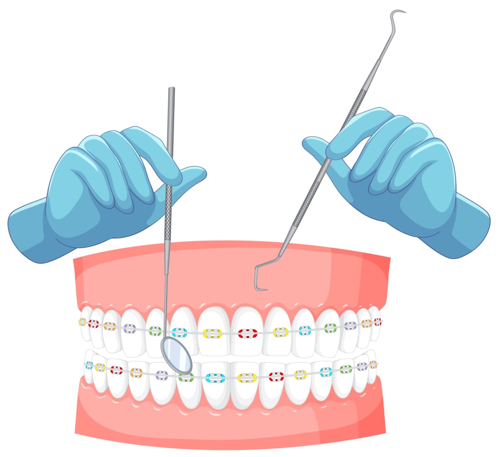 Orthodontic Treatment at BR Dental Hospital, Ghorahi, Dang