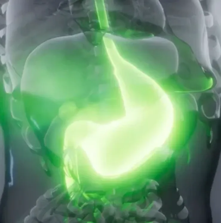 EsoRepair esophageal protection