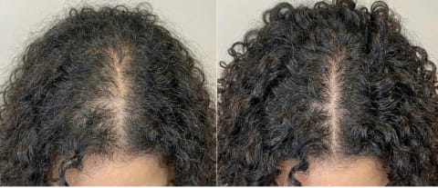 Curly hair thinning before and after 2 weeks