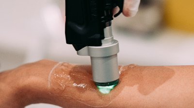 Laser Skin offer up to 50% off all treatments until May 2024 with 0% upfront 
