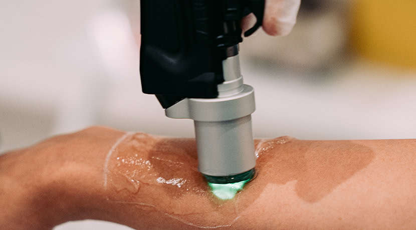 Laser Skin offer up to 50% off all treatments until May 2024 with 0% upfront 