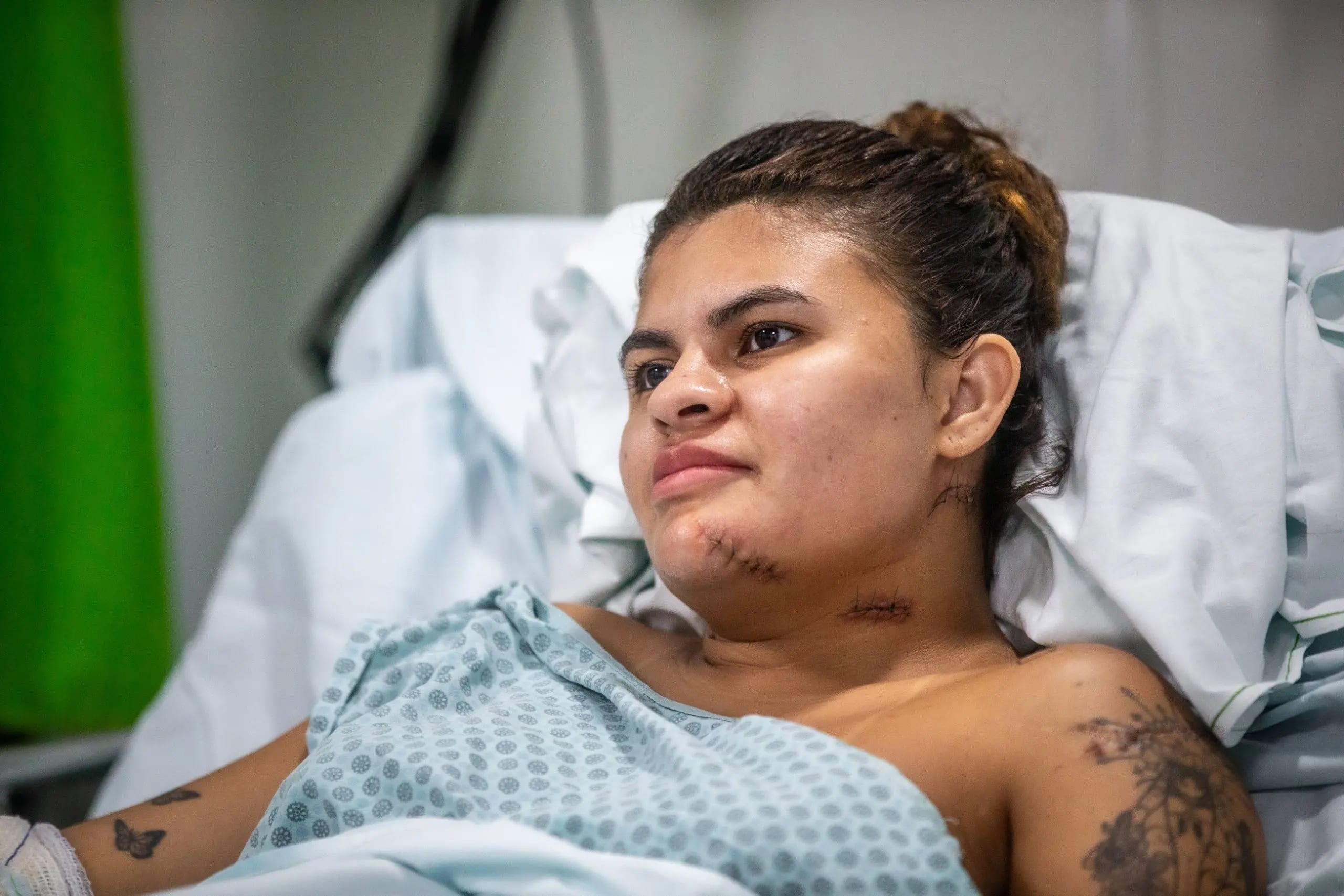 Jovem que teve mãos decepadas em Quixeramobim deve receber alta na próxima segunda-feira