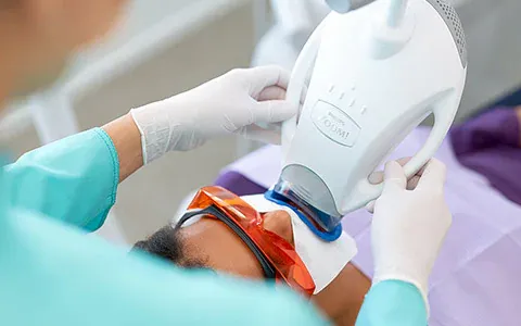 Whitening