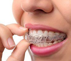Invisalign