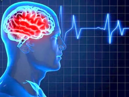 Предотвратить инсульт